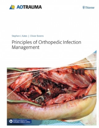 Kniha Principles of Orthopedic Infection Management L. Stephen Kates