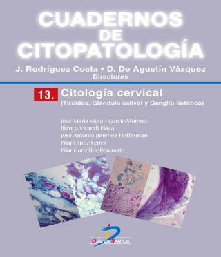 Knjiga Citología cervical JOSE MARIA VIGUER GARCIA MORANO