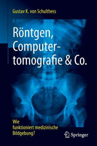 Kniha Roentgen, Computertomografie & Co. Gustav K. von Schulthess