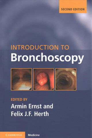 Kniha Introduction to Bronchoscopy Armin Ernst