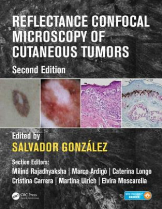 Könyv Reflectance Confocal Microscopy of Cutaneous Tumors 