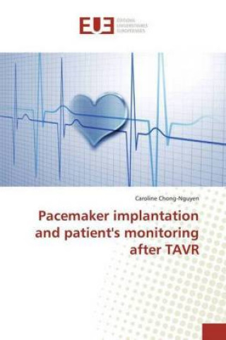 Book Pacemaker implantation and patient's monitoring after TAVR Caroline Chong-Nguyen