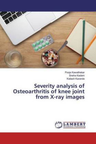 Kniha Severity analysis of Osteoarthritis of knee joint from X-ray images Pooja Kawathekar