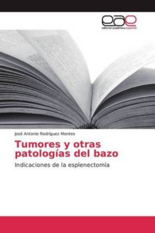 Carte Tumores y otras patologías del bazo José Antonio Rodríguez Montes