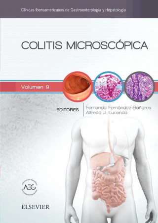 Kniha Colitis microscópica 