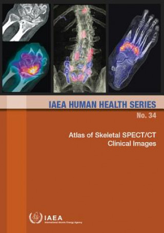 Knjiga Atlas of Skeletal SPECT/CT Clinical Images International Atomic Energy Agency