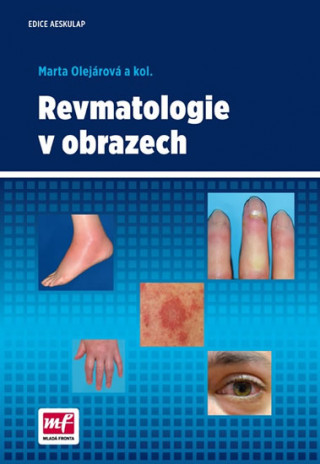 Kniha Revmatologie v obrazech Marta Olejárová