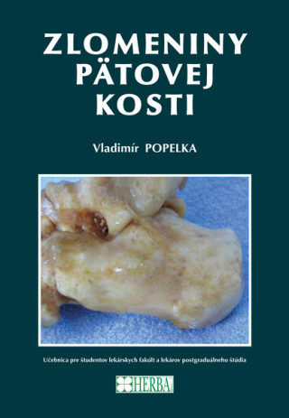 Carte Zlomeniny pätovej kosti Vladimír Popelka