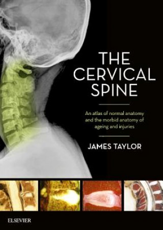 Kniha Cervical Spine USA) Taylor (both of University of California