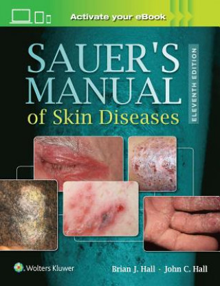 Könyv Sauer's Manual of Skin Diseases John Hall