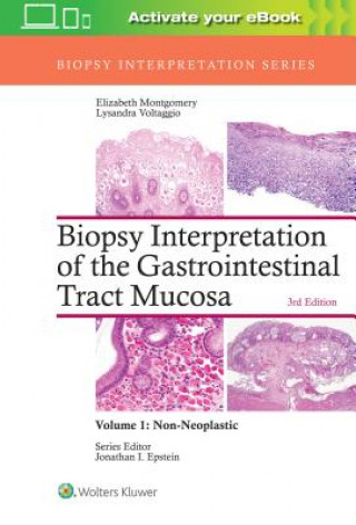 Książka Biopsy Interpretation of the Gastrointestinal Tract Mucosa: Volume 1: Non-Neoplastic Elizabeth A. Montgomery