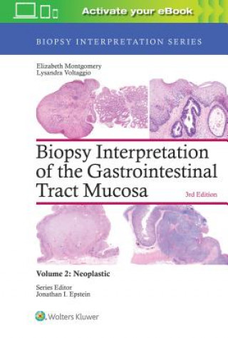 Kniha Biopsy Interpretation of the Gastrointestinal Tract Mucosa: Volume 2: Neoplastic Elizabeth A. Montgomery