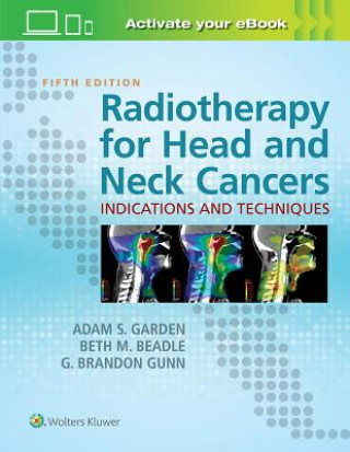 Książka Radiotherapy for Head and Neck Cancers Adam S. Garden