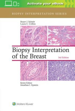 Książka Biopsy Interpretation of the Breast Stuart J Schnitt