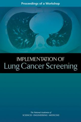 Buch Implementation of Lung Cancer Screening: Proceedings of a Workshop National Academies of Sciences Engineeri