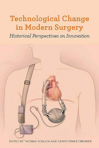Carte Technological Change in Modern Surgery Thomas Schlich