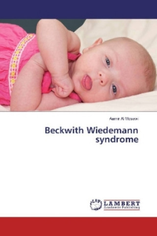 Carte Beckwith Wiedemann syndrome Aamir Al Mosawi