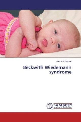 Knjiga Beckwith Wiedemann syndrome Aamir Al Mosawi