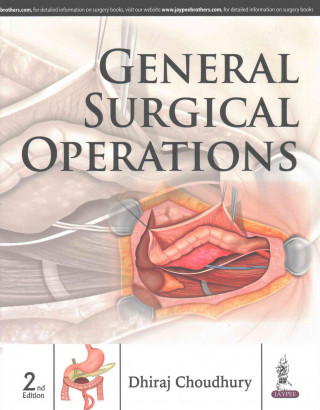 Kniha General Surgical Operations Dhiraj Choudhury