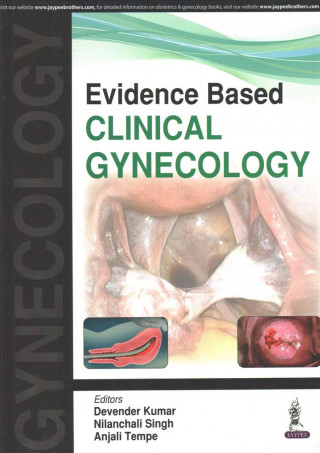 Książka Evidence Based Clinical Gynecology Devender Kumar