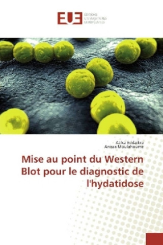 Könyv Mise au point du Western Blot pour le diagnostic de l'hydatidose Atika Eddaikra