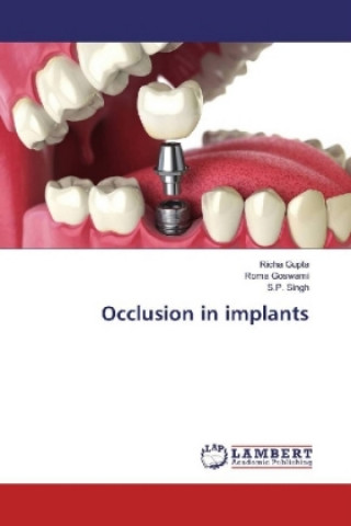 Könyv Occlusion in implants Richa Gupta