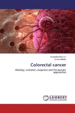 Kniha Colorectal cancer Alexandra Bolocan