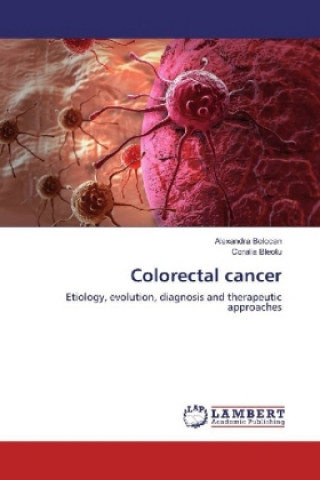 Βιβλίο Colorectal cancer Alexandra Bolocan