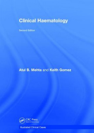 Livre Clinical Haematology MEHTA