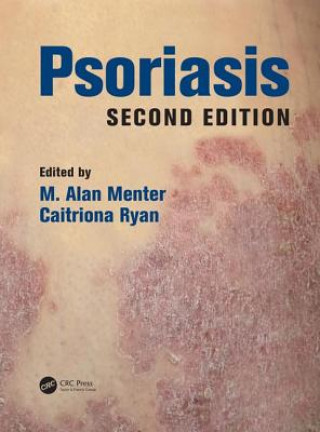 Boek Psoriasis M. Alan Menter