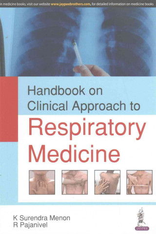 Kniha Handbook on Clinical Approach to Respiratory Medicine K Surendra Menon