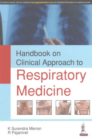 Książka Handbook on Clinical Approach to Respiratory Medicine K Surendra Menon