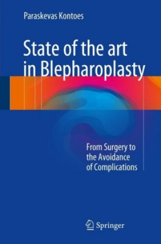 Книга State of the art in Blepharoplasty Paraskevas Kontoes