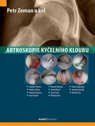 Kniha Artroskopie kyčelního kloubu Petr Zeman