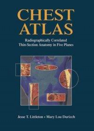 Könyv CHEST ATLAS 1994/E Mary L. Durizch