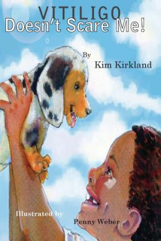 Könyv Vitiligo Doesn't Scare Me Kim Kirkland