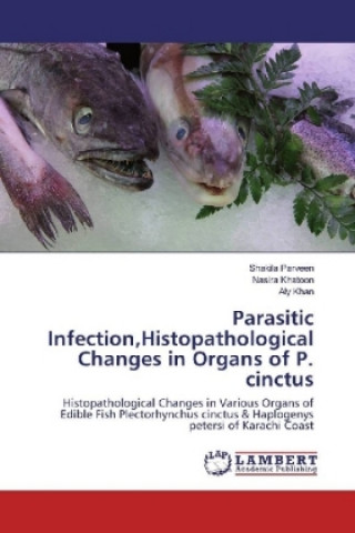 Kniha Parasitic Infection,Histopathological Changes in Organs of P. cinctus Shakila Parveen