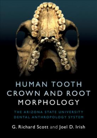 Книга Human Tooth Crown and Root Morphology G. Richard Scott
