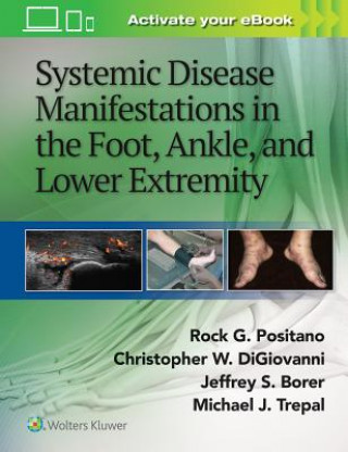 Buch Systemic Disease Manifestations in the Foot, Ankle, and Lower Extremity Rock G. Positano