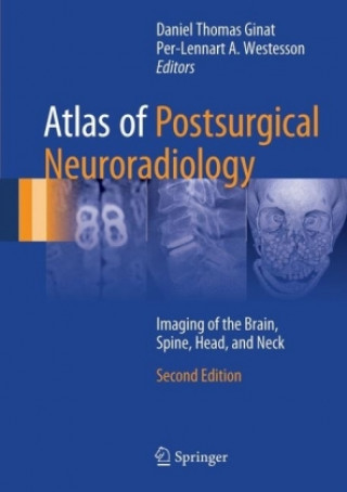 Kniha Atlas of Postsurgical Neuroradiology Daniel Ginat