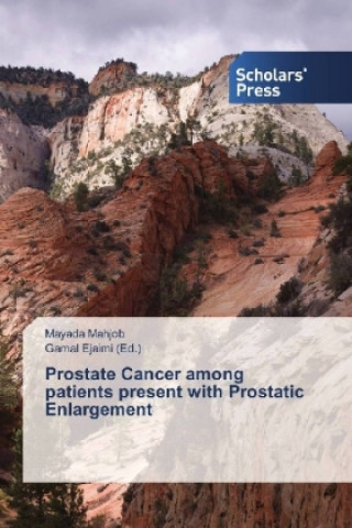 Książka Prostate Cancer among patients present with Prostatic Enlargement Mayada Mahjob