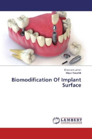 Könyv Biomodification Of Implant Surface Shabnam Jahan