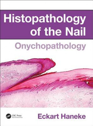 Kniha Histopathology of the Nail HANEKE