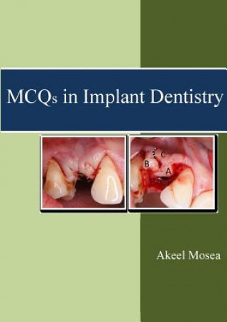 Kniha MCQS in Implant Dentistry Akeel Mosea