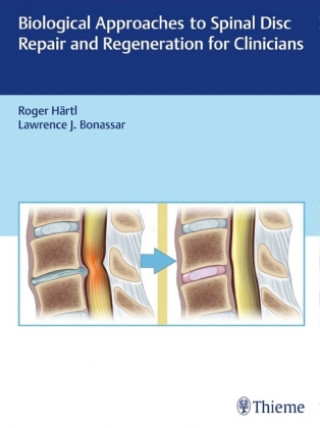 Carte Biological Approaches to Spinal Disc Repair and Regeneration for Clinicians Roger Hartl