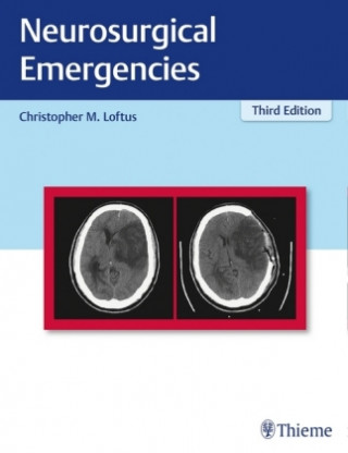 Kniha Neurosurgical Emergencies Christopher M. Loftus