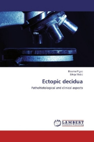 Knjiga Ectopic decidua Biserka Pigac