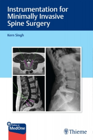 Carte Instrumentation for Minimally Invasive Spine Surgery Kern Singh