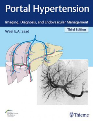 Kniha Portal Hypertension Wael E. A. Saad