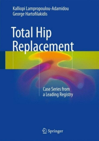 Book Total Hip Replacement Kalliopi Lampropoulou-Adamidou
